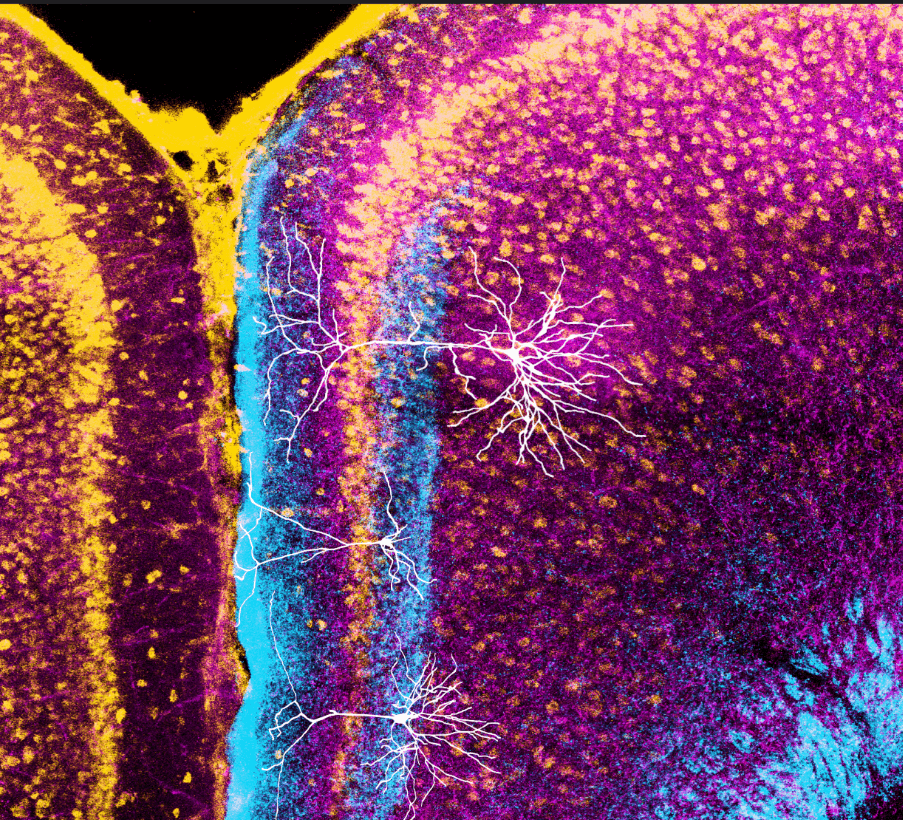 Colorful neural imagery