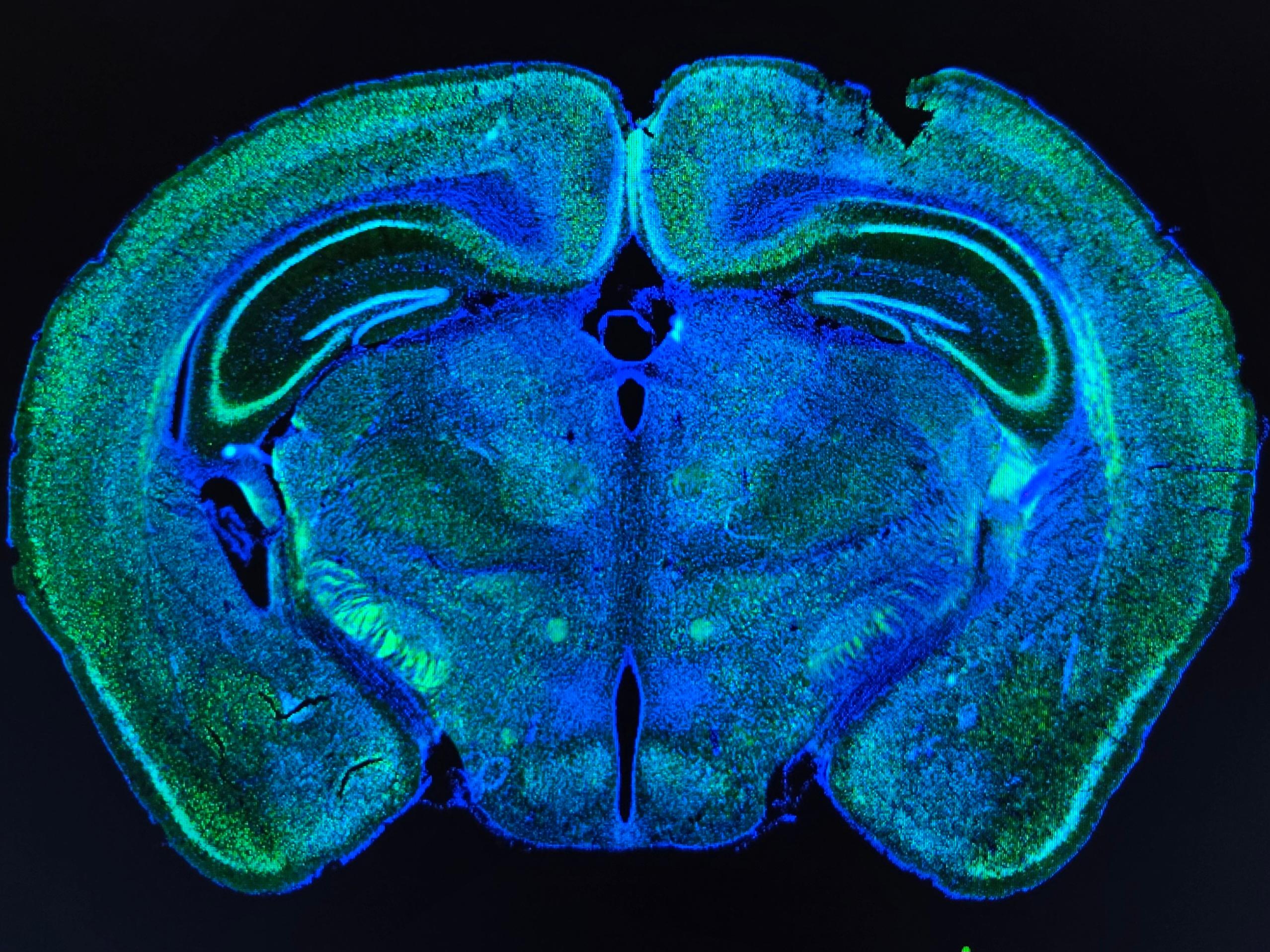 Colorful neural imagery
