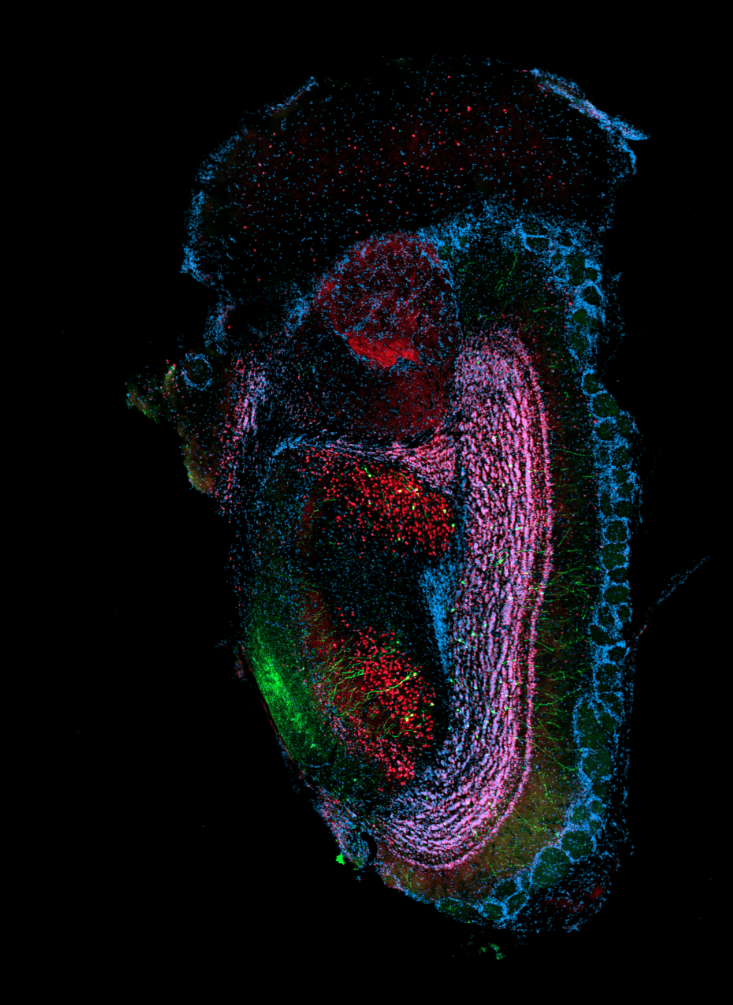 Colorful neural imagery